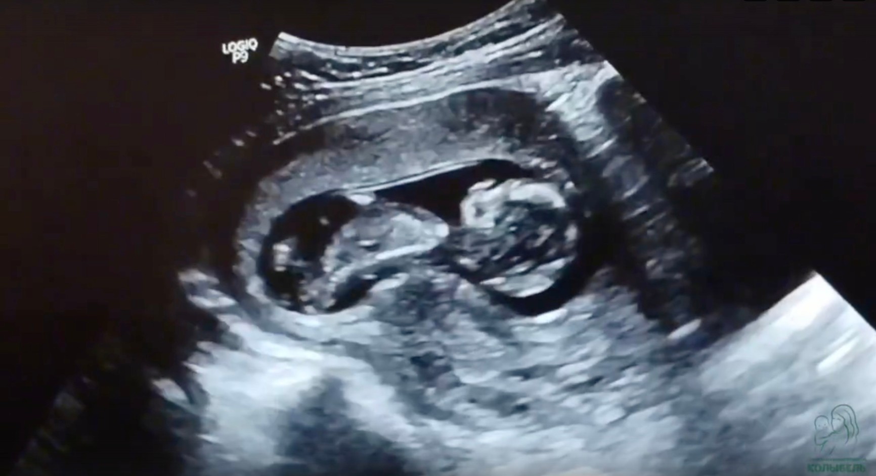 Ты выбрала любить – и так началась моя история